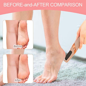 Electric Pedicure Foot File Callus Remover BRELZA