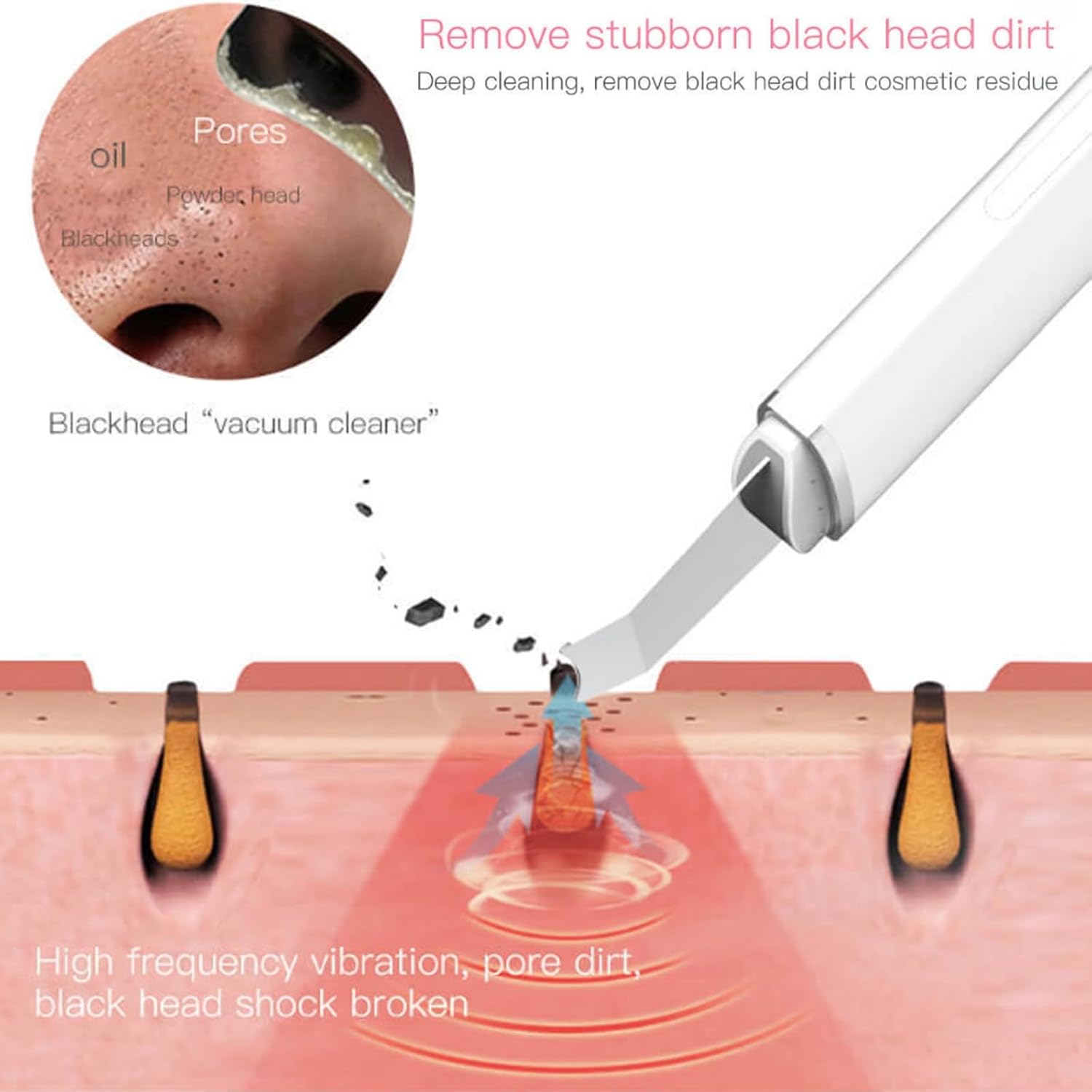 Face Blackhead Remover BRELZA
