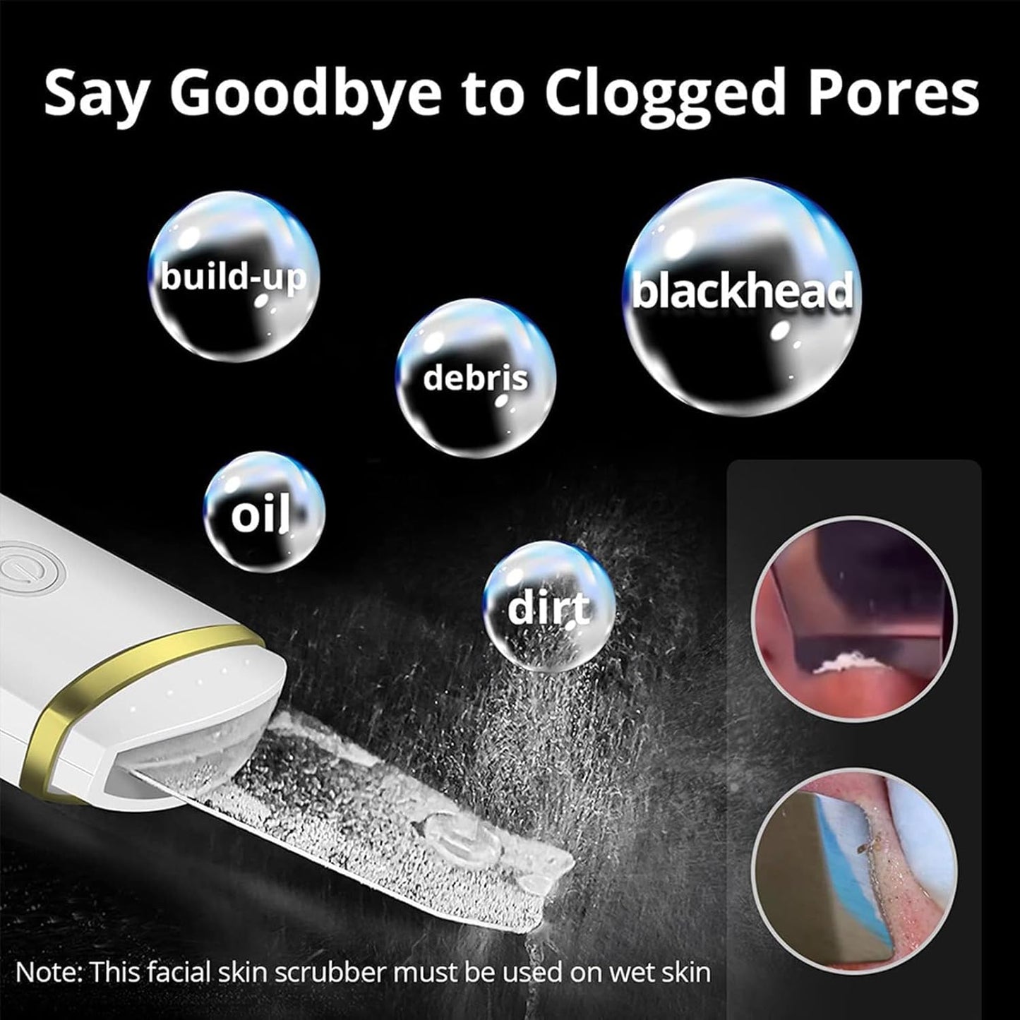 Face Blackhead Remover BRELZA