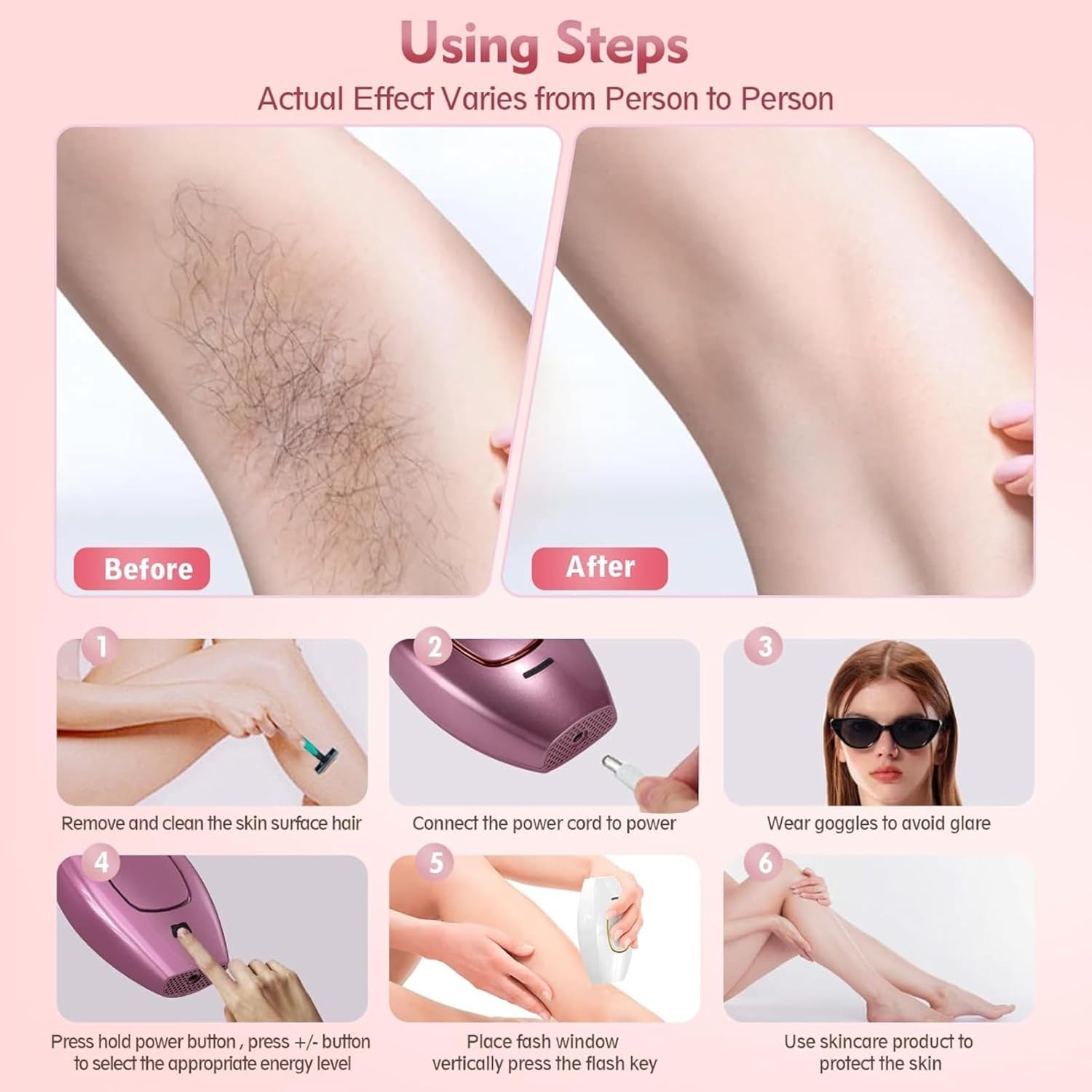 Mini Laser Hair Removal BRELZA