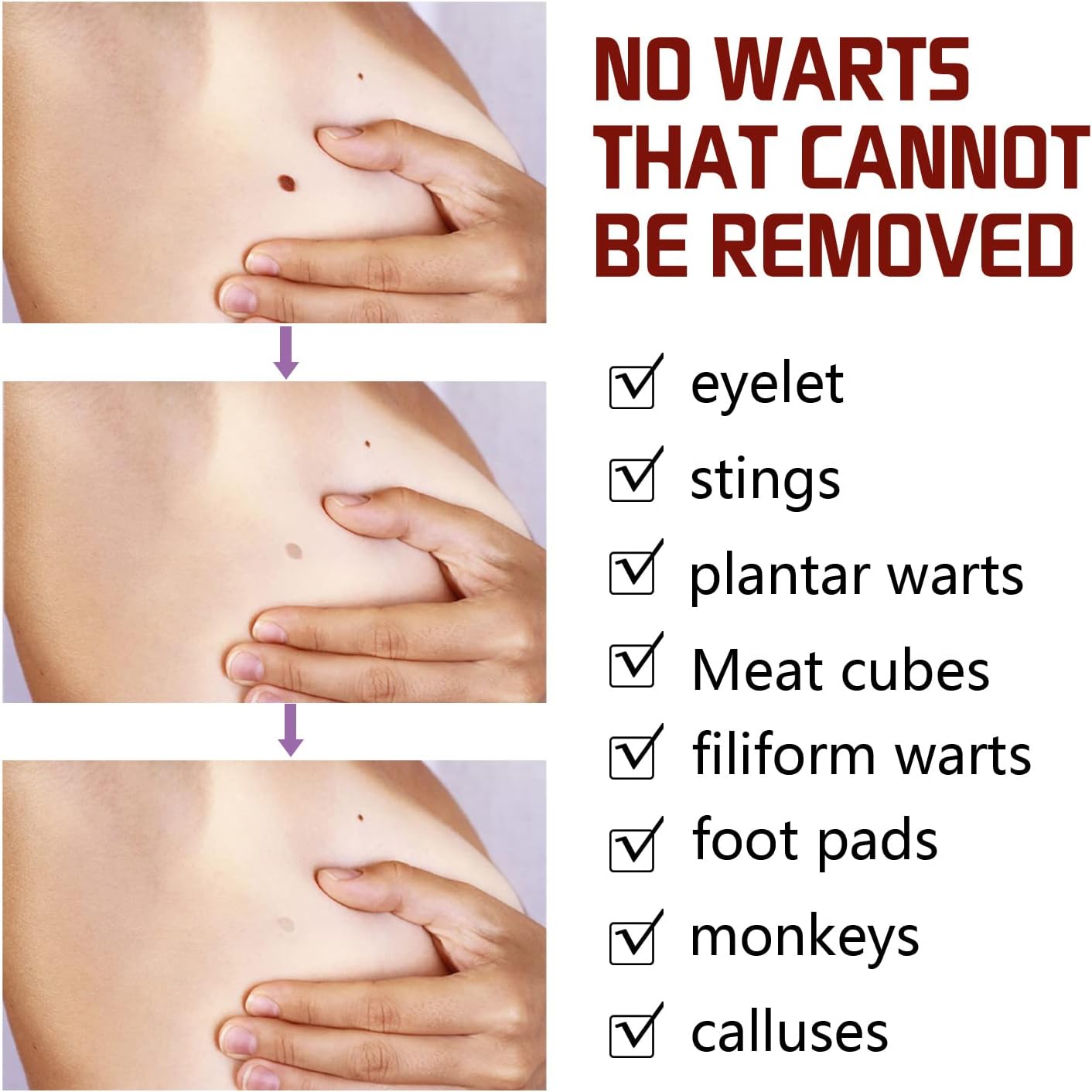 Instant Mole & Skin Tag Remover Pen