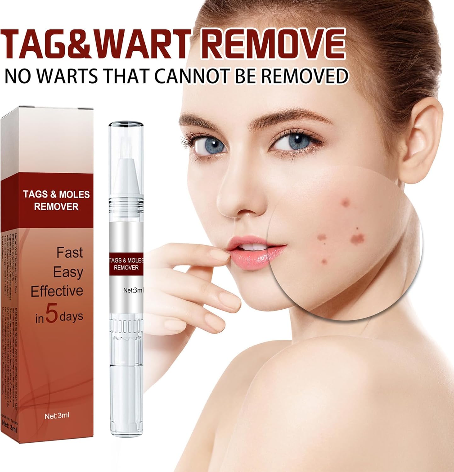 Instant Mole & Skin Tag Remover Pen