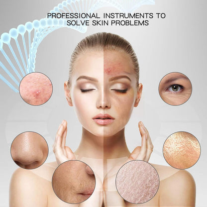 Face Blackhead Remover BRELZA