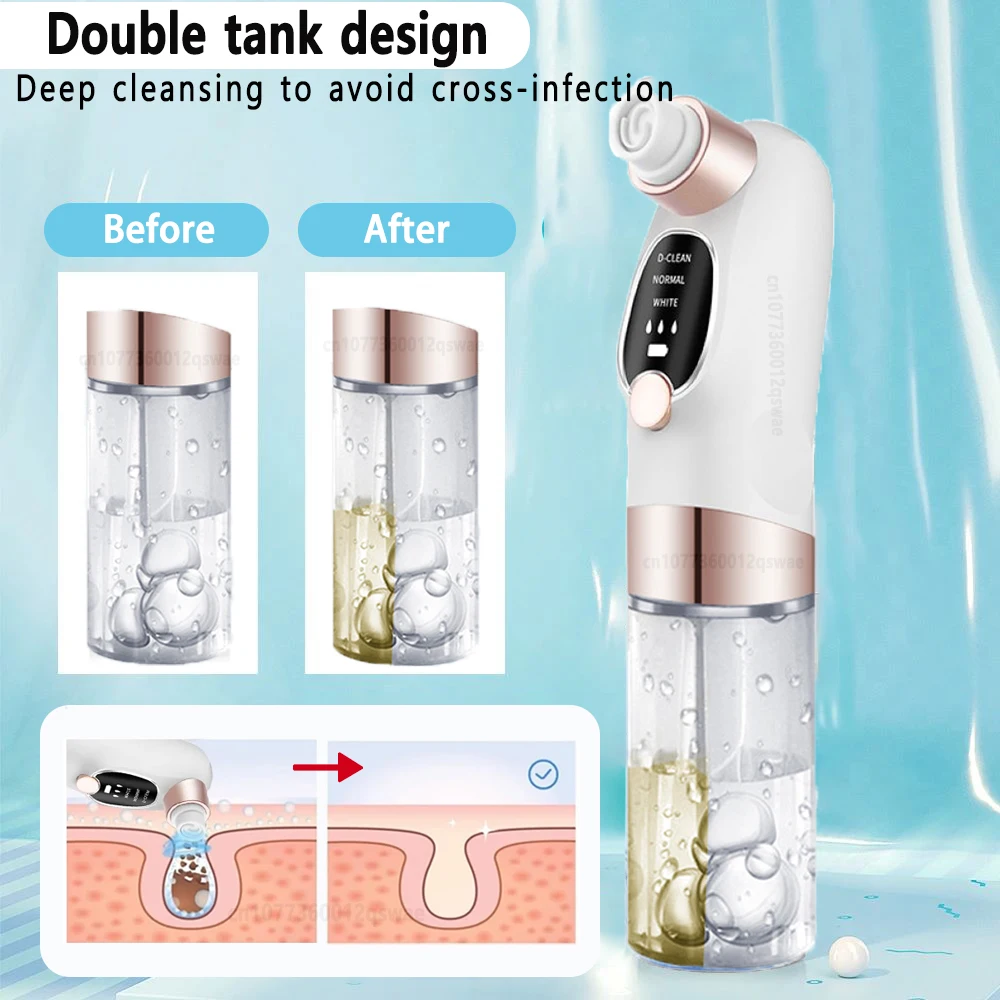 Electric Pore Vacuum | USB Rechargeable | Deep Clean & Gentle Skin Care Tool