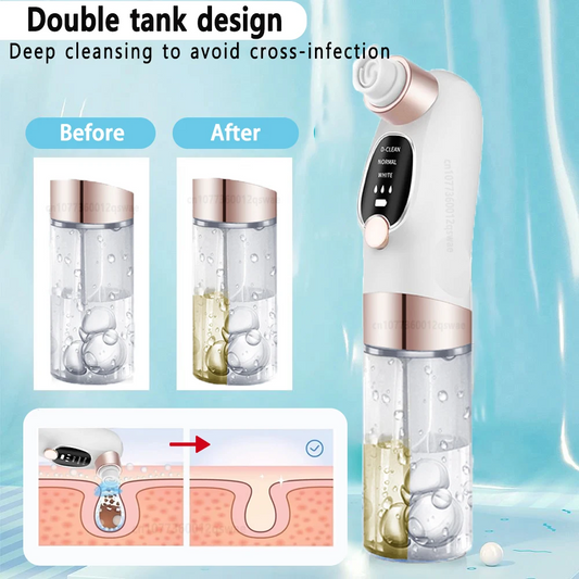 Electric Pore Vacuum | USB Rechargeable | Deep Clean & Gentle Skin Care Tool